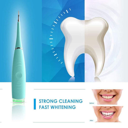 NITNOX™ SmilePro – Portable Electric Dental Plaque Remover